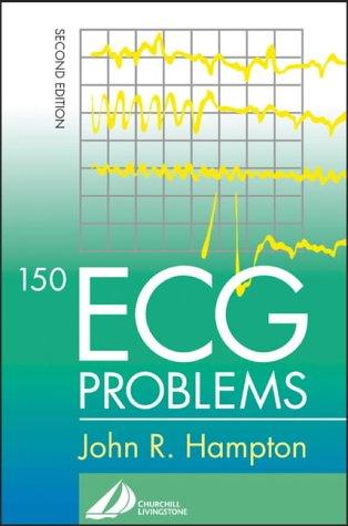 150 ECG Problems