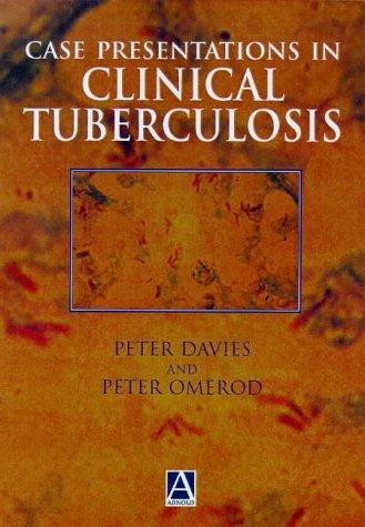 Case Presentations in Clinical Tuberculosis