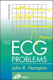 150 ECG Problems