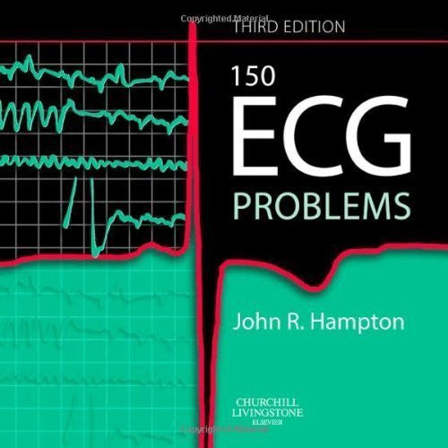 150 Ecg Problems