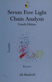 Serum Free Light Chain Analysis