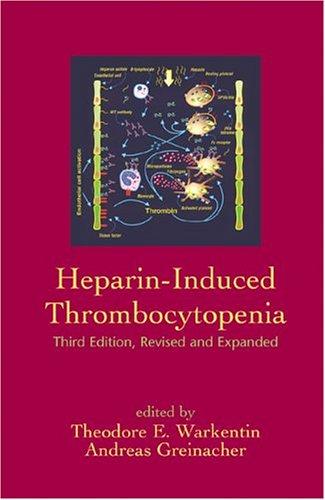 Heparin-Induced Thrombocytopenia