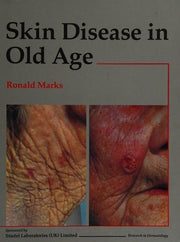 Skin Disease In Old Age