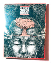 History of Shock Treatment