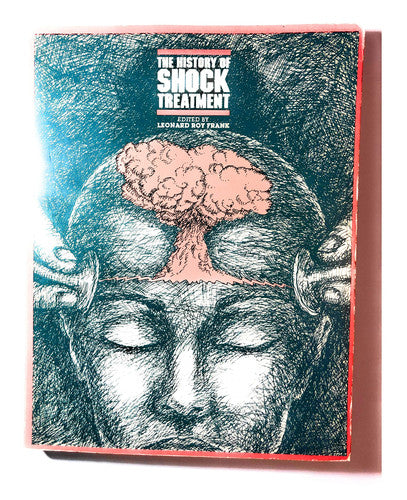 History of Shock Treatment