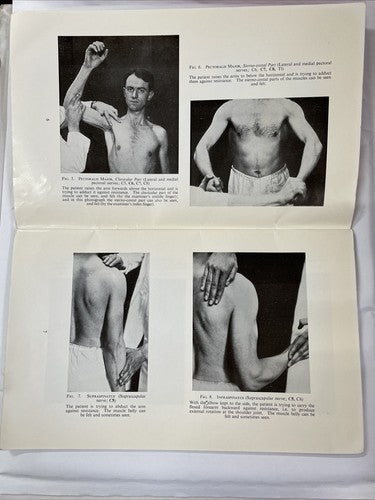 Aids to the Investigation of Peripheral Nerve Injuries (1965)