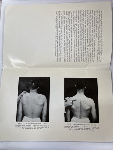 Aids to the Investigation of Peripheral Nerve Injuries (1965)